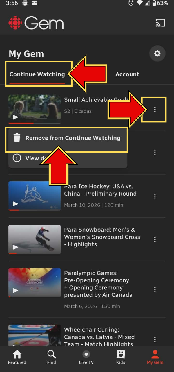 Remove content button.